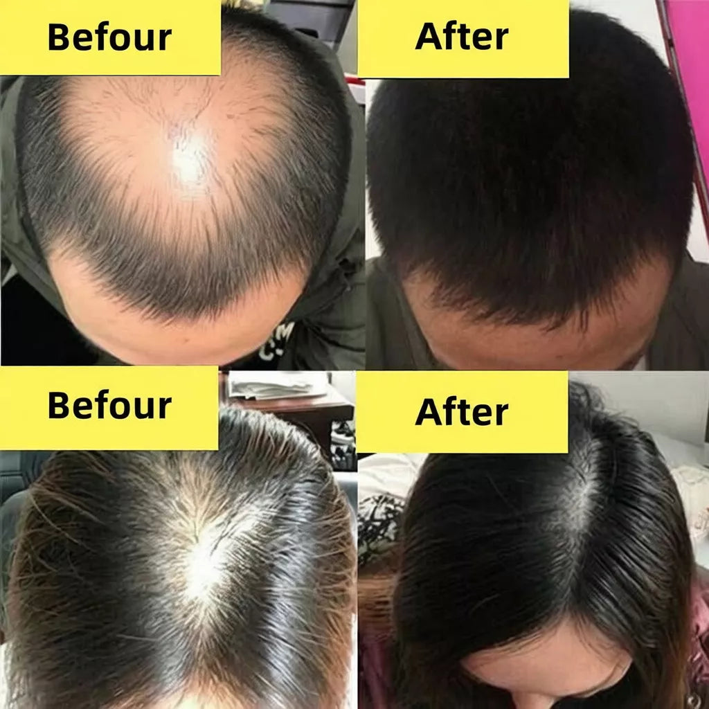 AZLA ginger shampoo with botanical extracts for scalp nourishment and stronger looking hair roots